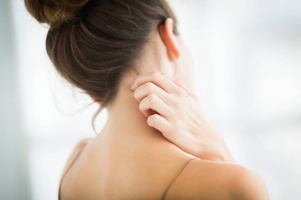 Mulher com dermatite se coçando