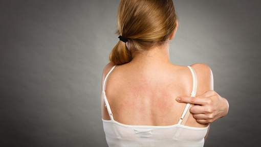 Mulher de costa apontando região vermelha na pele