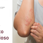 O que é molusco contagioso